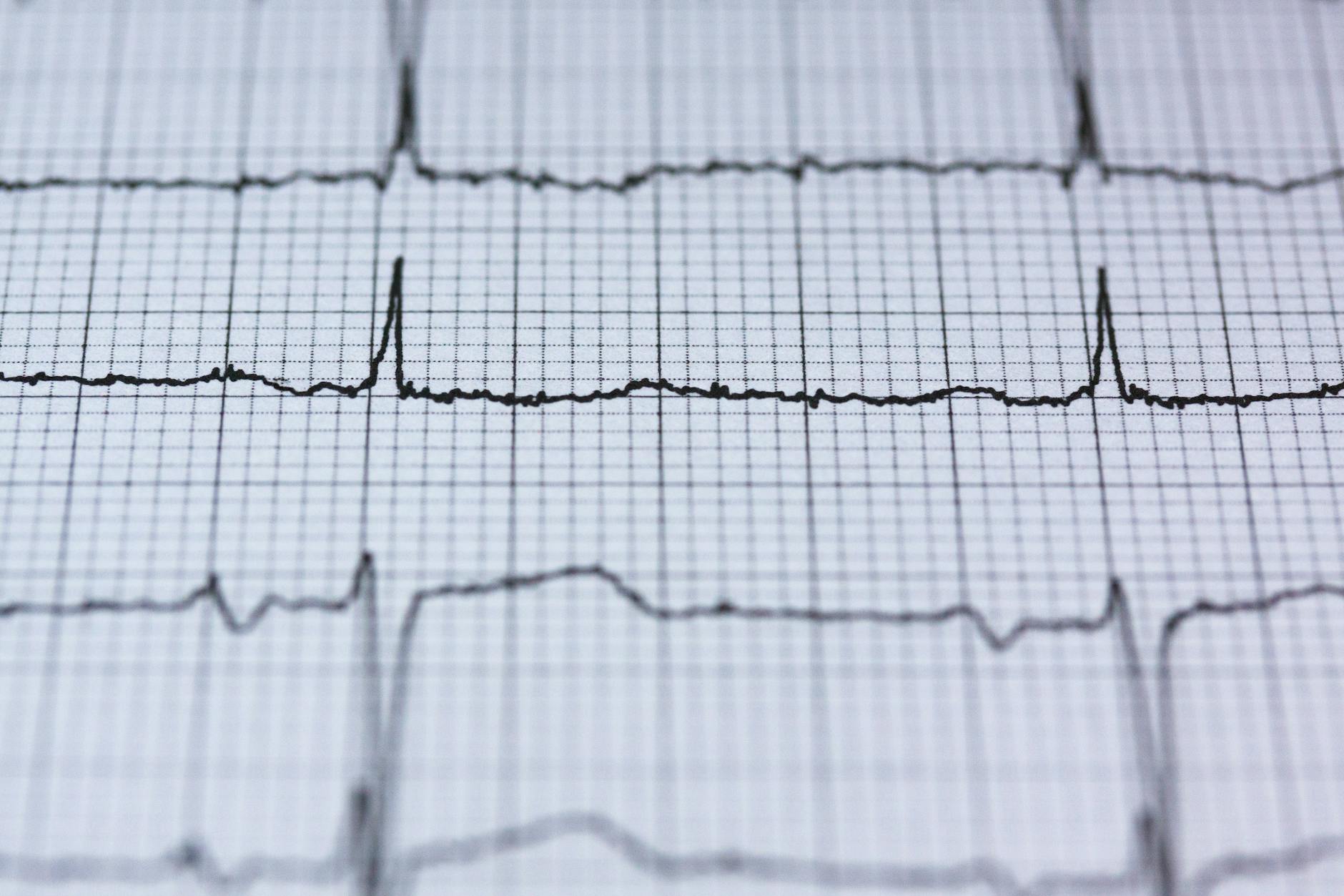 Eventos grátis em Lisboa: o que fazer quando o plano falha (e ainda assim curtes) 3 Close-up view of an ECG reading on graph paper, displaying heart rhythm and pulse data for medical analysis.
